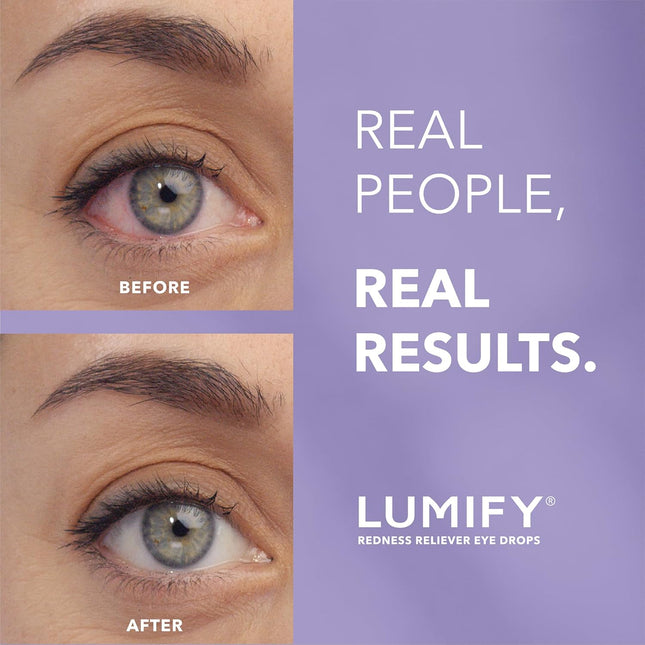 Lumify Eye Drops 7.5ml – Fast Acting Eye Brightening Drops, Long Lasting Formula
