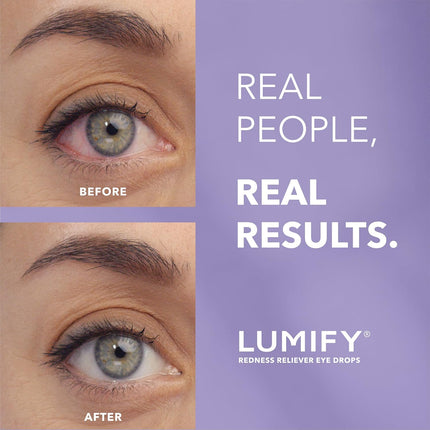 Lumify Redness Reliever Eye Drops - 2.5ml