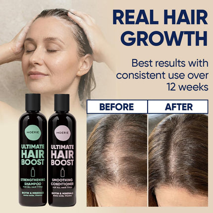 Moerie Hair Growth Shampoo and Conditioner with Biotin and Rosemary