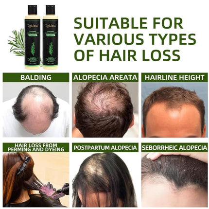 Tgideas Rosemary & Biotin Volumizing Shampoo 7.4 fl oz