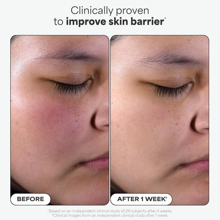 Paula’s Choice Skin Perfecting 2% BHA Liquid Exfoliant – Salicylic Acid, Fragrance-Free, 118 ml