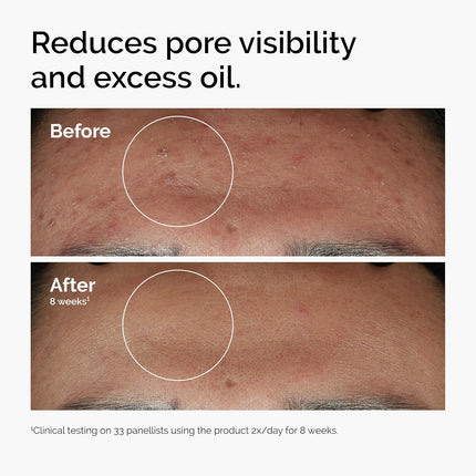 The Ordinary Serum Set Hyaluronic Acid 2% B5 Niacinamide 10% Zinc 1% Caffeine Solution 5%
