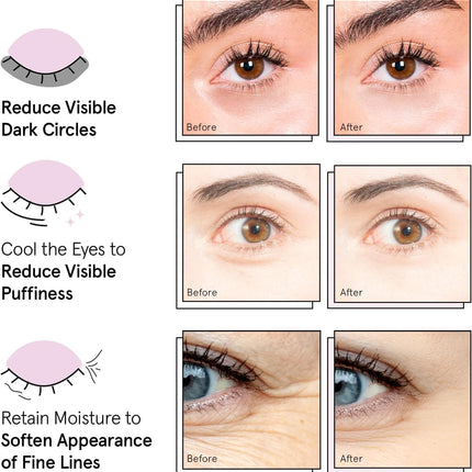 grace & stella Vegan Under Eye Patches for Dark Circles & Puffy Eyes 12 Pairs